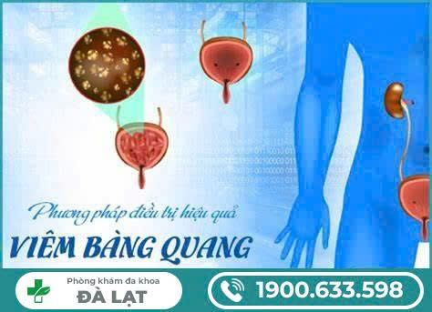 Hình ảnh minh họa